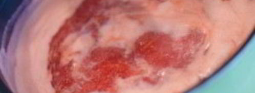 клубничный джем без сахара. Шаг 7